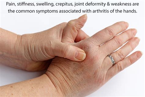 Arthritis In Hands Causes Symptoms And Diagnosis