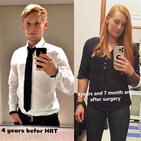 Transtimeline : r/transtimelines