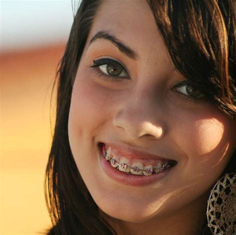 Pin By John Beeson On Girls In Braces In Nose Ring Girl Braces