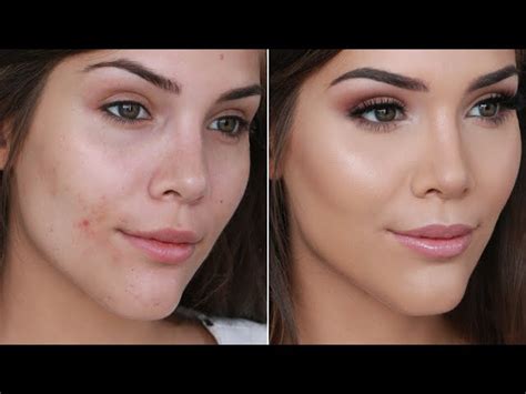 How To Hide Red Spots On Face Without Makeup