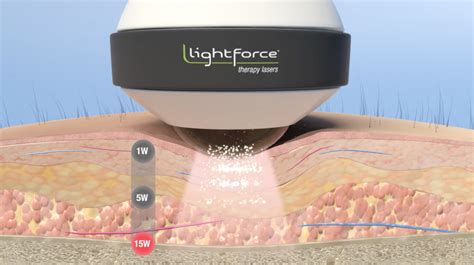 Laser Forum Part 1 Understanding Terms That Describe Photobiomodulation Pbm Lightforce