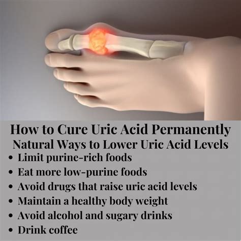 How To Cure Uric Acid Permanently Some Tips On Treat Your Gout Naturally