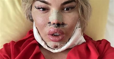 Mariana lima, 24 anos, 2 anos em transição. Jessica Alves se submete a rinoplastia-veja o antes e ...