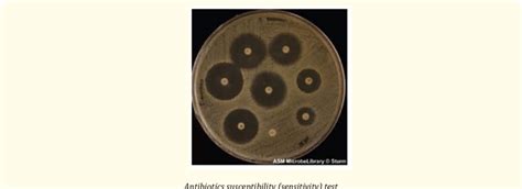 Thin Paper Discs Containing An Antibiotic Placed On Agar Plate