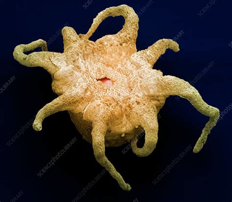 Jellyfish Larva Sem Stock Image C0046487 Science Photo Library
