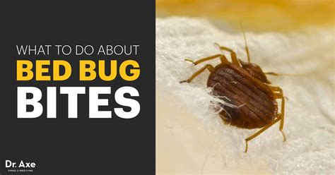 Bed Bug Bites Symptoms Facts And Natural Treatments Dr Axe