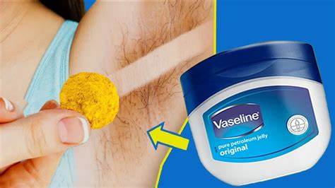 In 5 Minutes Remove Unwanted Armpit Hair Permanently Unwanted Hair