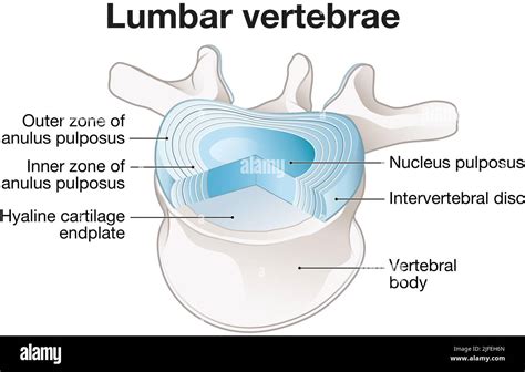 Illustration Showing Healthy Lumbar Vertebrae And Intervertebral Disc
