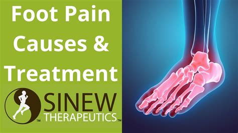 Foot Pain Causes And Treatment Youtube