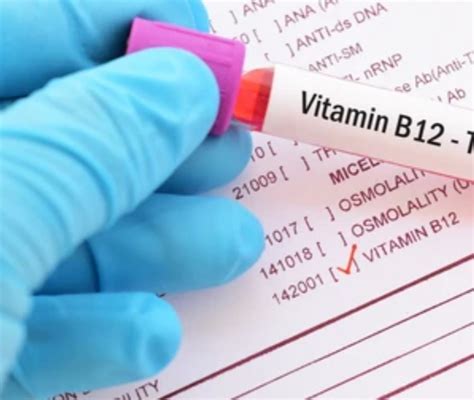 Vitamin B12 Are You Getting Enough Vegan Melanated