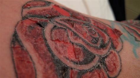 Le Migliori 20 Come Capire Se Il Tatuaggio è Guarito Il Migliore Ban