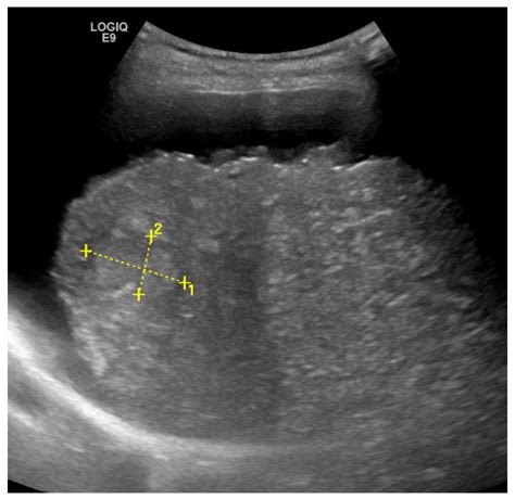 Jcm Free Full Text Role Of Ultrasound Methods For The Assessment Of