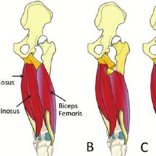 Hamstrings are a muscle part that is often omitted. Leg Muscles Diagram Hamstring / Easy Muscle Building Tips ...