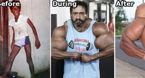 Bodybuilder Injects Oil Into His Muscles Even Though It Could Kill Him