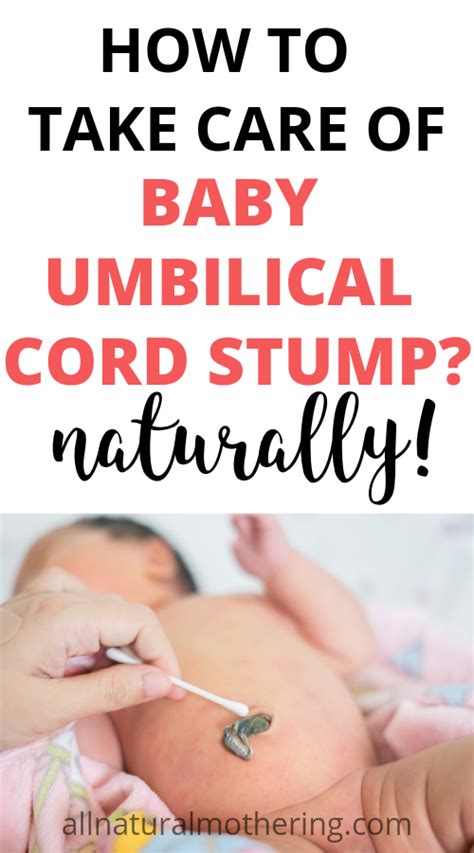 Umbilical Cord Stump Care A Comprehensive Guide Dixon Verse