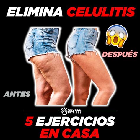 🛑elimina Celulitis De Tus Piernas 😱con 5 Ejercicios En Casa 4 Semanas