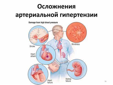 Синдром артериальной гипертензии - презентация онлайн Картинка - Синдром артериальной гипертензии - презентация онлайн