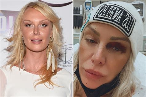 Antms Caridee English Rushed To Hospital After Suffering ‘serious Head