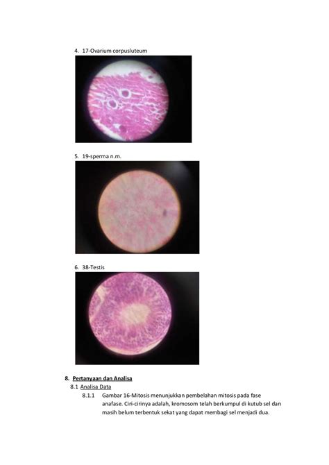 Biologi 12 Laporan Praktikum Mitosis Dan Meiosis