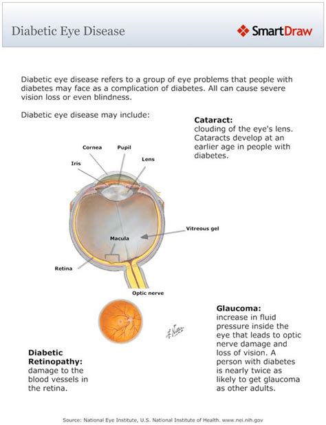 Diabetic retinopathy and diabetic macular edema symptoms. Diabetic Eye Disease