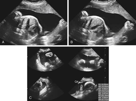 Fetal Anomaly Radiology Key