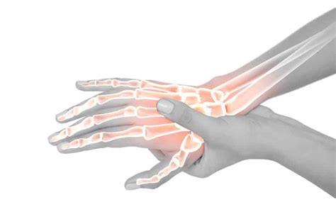 Is My Wrist Broken Or Sprained Injury Health Blog