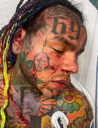 tekashi 6ix9ine rushed to florida hospital with shock injuries after group jumped him in gym