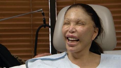 Botched Before And After A Transgender Surgery Addict A Cleft Lip And Much More—see The Season
