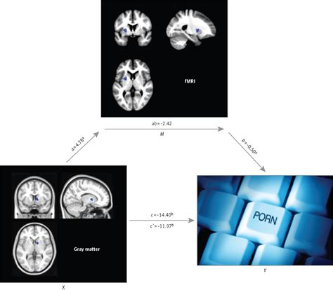 Brain Structure And Functional Connectivity Associated With Pornography