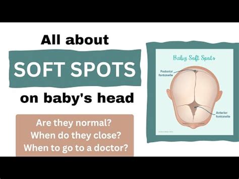 All About Soft Spots On Baby S Head I When Do Soft Spots Go Away Are