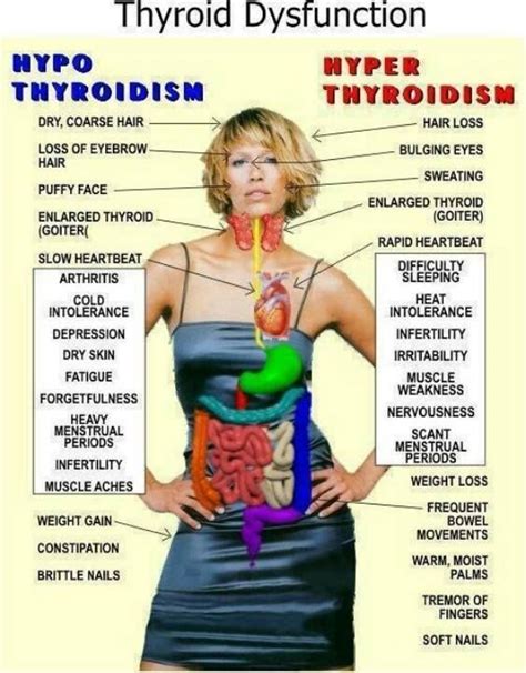 Pin On Thyroid