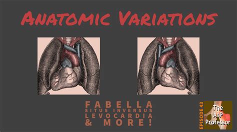 Anatomic Variations In Humans Fabella Situs Inversus Tapp 43