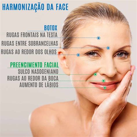 Anatomia Da Face Para Botox