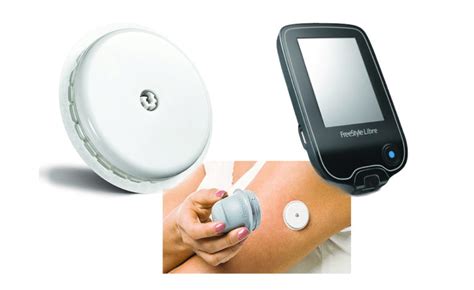 Home Health Tech Test Glucose Levels For Diabetes Via Patch Doctor Zac
