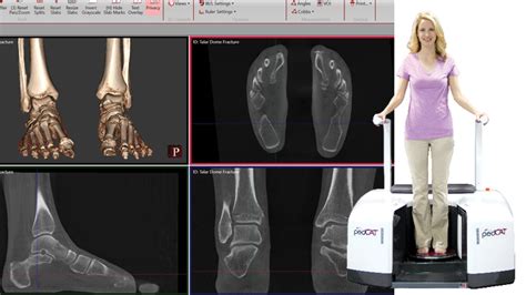 Standing Ct Imaging Foot Care Group