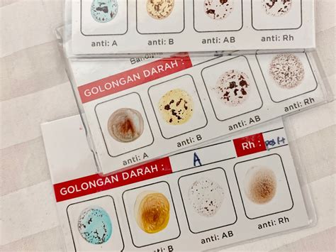 Tes Golongan Darah – newstempo