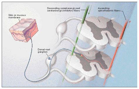 Postherpetic Neuralgia — Pathogenesis Treatment And Prevention Nejm