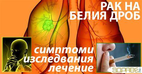 Диета при рак