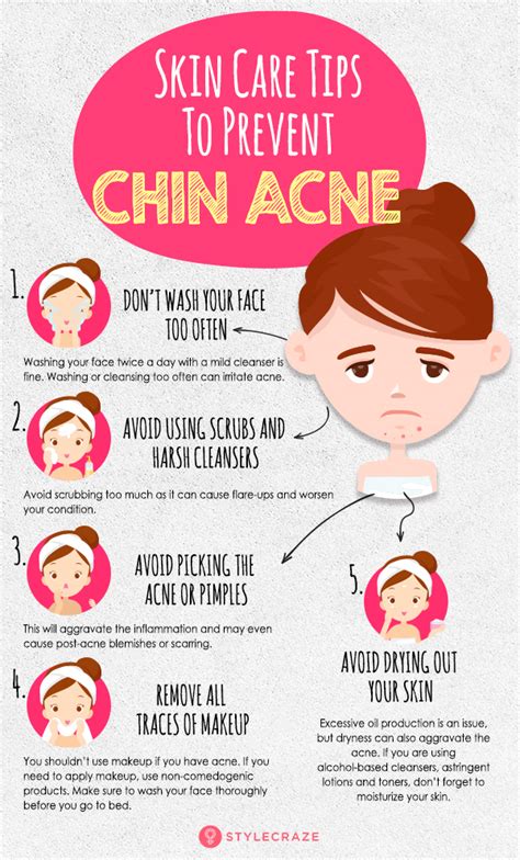 Chin Acne What Is It Causes And How To Treat It