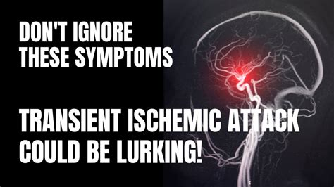 The Risk Of Transient Ischemic Attack Tia Causes Symptoms