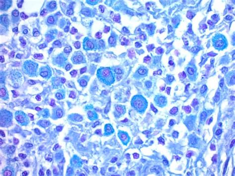 Eosinophil Mast Cell Stain Kit Hematologic Stain Ab150665 Abcam