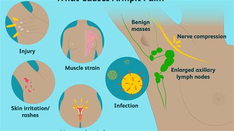 Pictures Of Swollen Lymph Nodes In Armpit Swollen Lymph Nodes