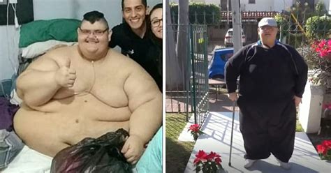 The Heaviest Man In The World Lost More Than 330 Kg