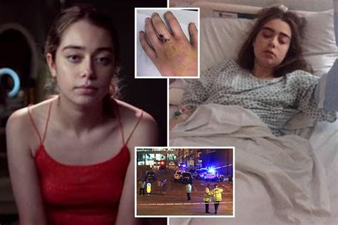 Manchester Arena Terror Attack Victim 6ft From Blast Tells Of Moment