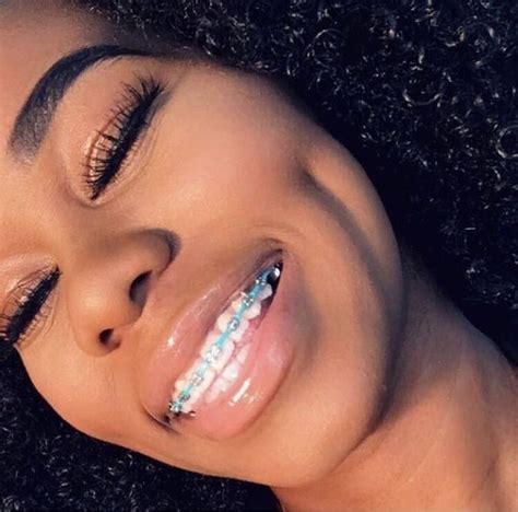 Pinterest Yagurlfaith 🤤🖤 Cute Braces Brace Face Teeth Braces