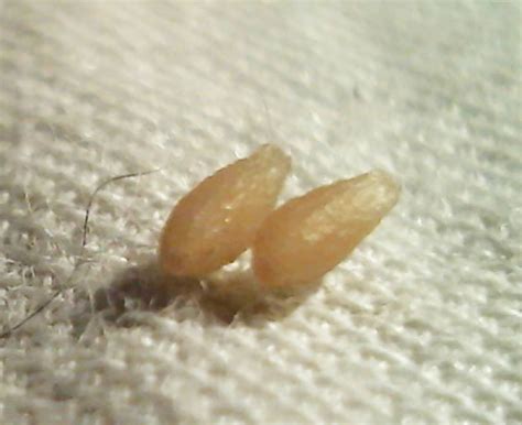 What do tapeworms in cats look like? File:Desiccated tapeworm proglottids.jpg - Wikimedia Commons