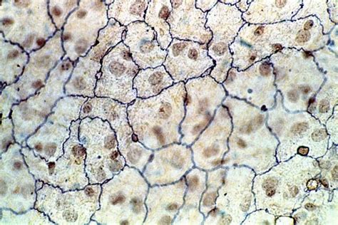 Simple Squamous Epithelium Flat Mount Squamous Histology Slides Tissue