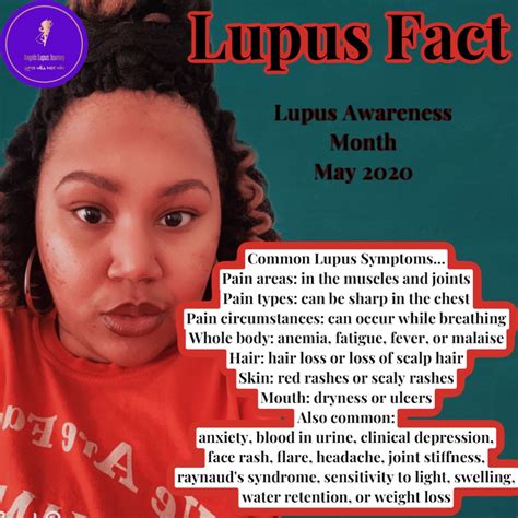 Lupus Fact Angels Lupus Journey