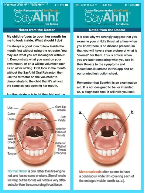 A sore throat can be managed at home to promote healing and ease the pain. Moms' Tips To Soothe A Sore Throat! - Fun Learning Life