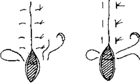 Vertical mattress sutures are particularly useful in wounds under tension. Cross mattress suture pattern | definition of cross ...